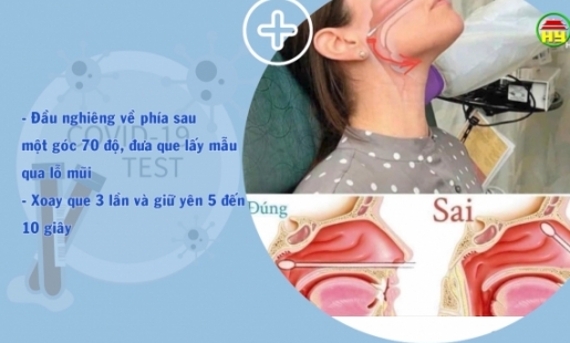 Hướng dẫn xét nghiệm nhanh tại nhà